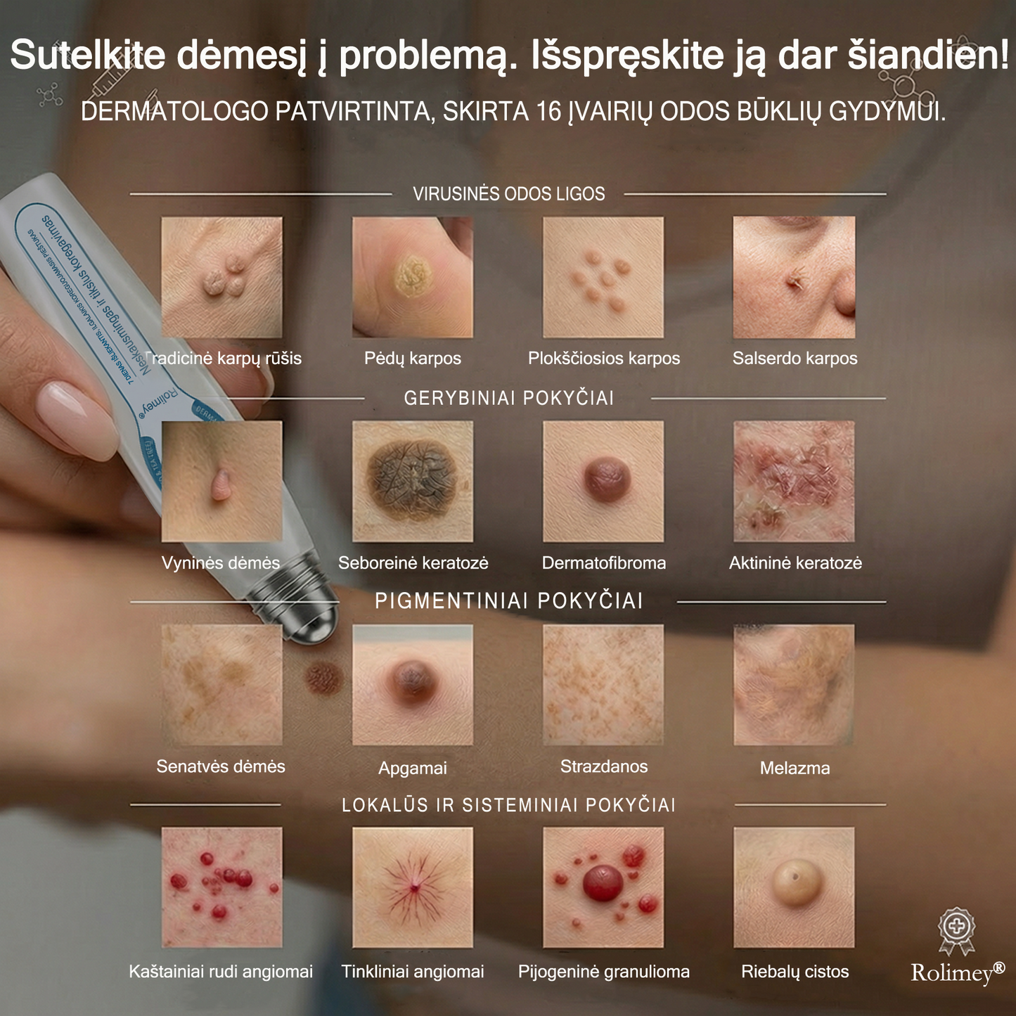 👨‍🔬🧊 Oficiali parduotuvė | ✅ Rolimey® 7 dienų roll-on priemonė odos ataugėlėms, karpoms ir pigmentinėms dėmėms-7141